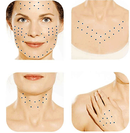 Skinbooster restylane skinbooster behandeling skin booster voor en na skinbooster prijs skinbooster den haag