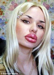 botox lippen den haag