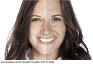 huidveroudering door UV straling