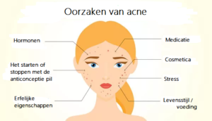 acne behandeling acne littekens verwijderen